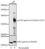 Phospho-PLCG2 (Tyr1217) Antibody in Western Blot (WB)