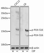 Phospho-Phospholamban (Ser16) Antibody in Western Blot (WB)