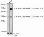 Phospho-Aurora A/B/C (Thr288, Thr232, Thr198) Antibody in Western Blot (WB)