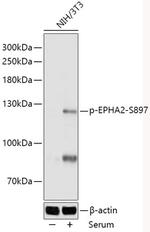 Phospho-EphA2 (Ser897) Antibody in Western Blot (WB)