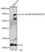 Phospho-Tau (Ser198, Ser199, Ser202) Antibody in Western Blot (WB)