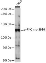 Phospho-PKC mu (Ser916) Antibody in Western Blot (WB)