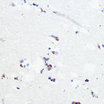 Phospho-Tau (Ser416) Antibody in Immunohistochemistry (Paraffin) (IHC (P))