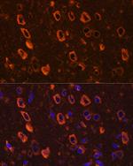 Phospho-Tau (Ser416) Antibody in Immunohistochemistry (Paraffin) (IHC (P))