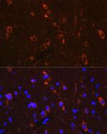 Phospho-Tau (Ser416) Antibody in Immunohistochemistry (Paraffin) (IHC (P))