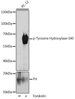 Phospho-Tyrosine Hydroxylase (Ser40) Antibody in Western Blot (WB)