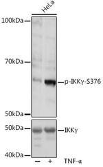 Phospho-IKK gamma (Ser376) Antibody in Western Blot (WB)