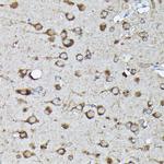 Phospho-K-Ras (Ser89) Antibody in Immunohistochemistry (Paraffin) (IHC (P))