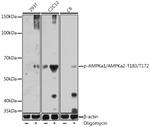 Phospho-AMPK alpha-1,2 (Thr183, Thr172) Antibody in Western Blot (WB)