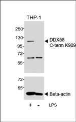 RIG-I Antibody in Western Blot (WB)