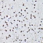 Phospho-c-Jun (Ser63) Antibody in Immunohistochemistry (Paraffin) (IHC (P))