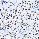 Phospho-c-Jun (Ser63) Antibody in Immunohistochemistry (Paraffin) (IHC (P))