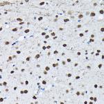 Phospho-c-Jun (Ser63) Antibody in Immunohistochemistry (Paraffin) (IHC (P))