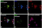 RIG-I Antibody in Immunocytochemistry (ICC/IF)