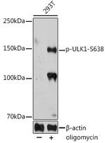 Phospho-ULK1 (Ser638) Antibody in Western Blot (WB)