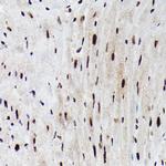 Phospho-FOXO3A (Ser425) Antibody in Immunohistochemistry (Paraffin) (IHC (P))