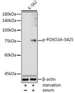 Phospho-FOXO3A (Ser425) Antibody in Western Blot (WB)