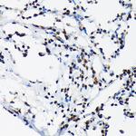 Phospho-c-Jun (Thr91) Antibody in Immunohistochemistry (Paraffin) (IHC (P))