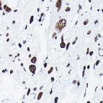 Phospho-c-Jun (Thr91) Antibody in Immunohistochemistry (Paraffin) (IHC (P))