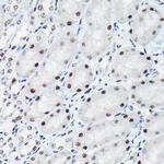 Phospho-c-Jun (Thr91) Antibody in Immunohistochemistry (Paraffin) (IHC (P))