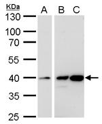 Calponin 3 Antibody in Western Blot (WB)