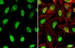 PPM1D Antibody in Immunocytochemistry (ICC/IF)