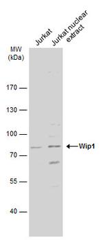 PPM1D Antibody in Western Blot (WB)