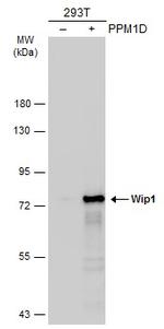 PPM1D Antibody in Western Blot (WB)