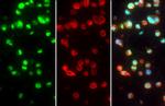 ZFP36 Antibody in Immunocytochemistry (ICC/IF)