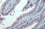 GALNT3 Antibody in Immunohistochemistry (Paraffin) (IHC (P))