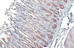 GALNT3 Antibody in Immunohistochemistry (Paraffin) (IHC (P))