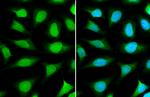 NUP153 Antibody in Immunocytochemistry (ICC/IF)