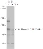 Phospho-JAK2 (Tyr1007, Tyr1008) Antibody in Western Blot (WB)