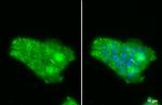 NGAL Antibody in Immunocytochemistry (ICC/IF)