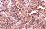 CD63 Antibody in Immunohistochemistry (Paraffin) (IHC (P))