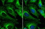 Clathrin Heavy Chain Antibody in Immunocytochemistry (ICC/IF)