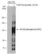 Phospho-PLCG2 (Tyr1217) Antibody in Western Blot (WB)