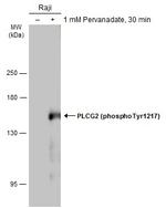 Phospho-PLCG2 (Tyr1217) Antibody in Western Blot (WB)