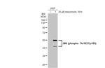 Phospho-JNK1 (Thr183, Tyr185) Antibody in Western Blot (WB)