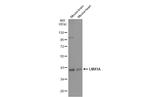 LMX1A Antibody in Western Blot (WB)