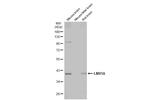 LMX1A Antibody in Western Blot (WB)