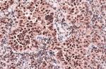 CENPA Antibody in Immunohistochemistry (Paraffin) (IHC (P))