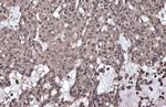 Phospho-IKK gamma (Ser376) Antibody in Immunohistochemistry (Paraffin) (IHC (P))