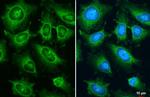 AJUBA Antibody in Immunocytochemistry (ICC/IF)