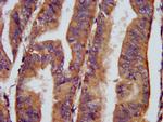 CHRNB3 Antibody in Immunohistochemistry (Paraffin) (IHC (P))