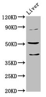 CHRNB3 Antibody in Western Blot (WB)