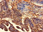 CLASP2 Antibody in Immunohistochemistry (Paraffin) (IHC (P))