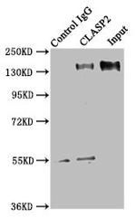 CLASP2 Antibody in Immunoprecipitation (IP)