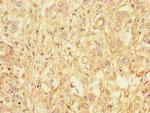 GAA Antibody in Immunohistochemistry (Paraffin) (IHC (P))