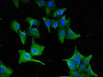 GNAT1 Antibody in Immunocytochemistry (ICC/IF)